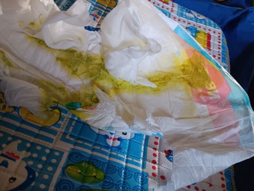 Bun anak saya sdah 3 hari ini pup seperti itu, sehari bisa lebih dari 5x, aman gak bun?