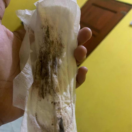 Apakah ini keguguran