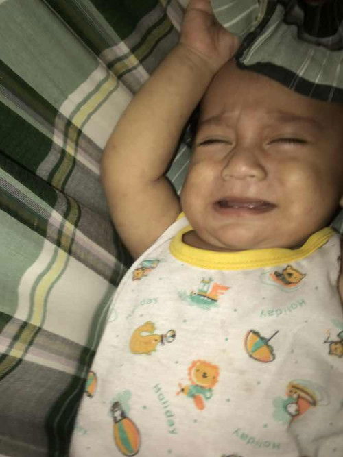 Obat dari biang keringat