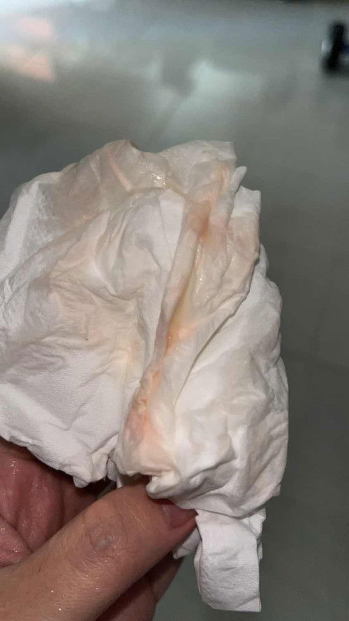 37 minggu 1 hari HpL 9 April