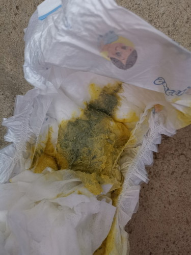 Normal po ba tong color ng poop ng baby ko?