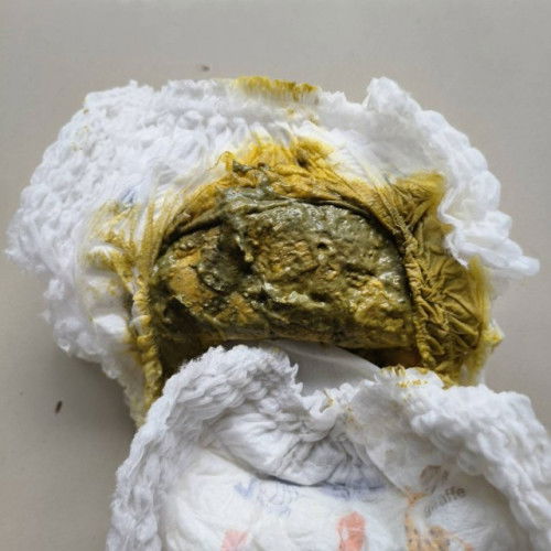 ฮึลูกเป็นสีเขียวๆเทาๆ