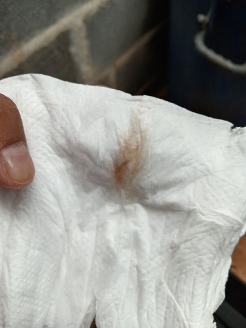 39+4  ท้องแรก