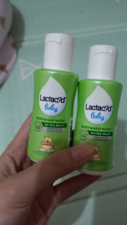 Menang kontes tapi lupa