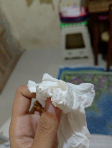 Assalamualaikum Bun mau tanya kan saya belum telat haid tapi ditespek garis dua keluar flek apabahay