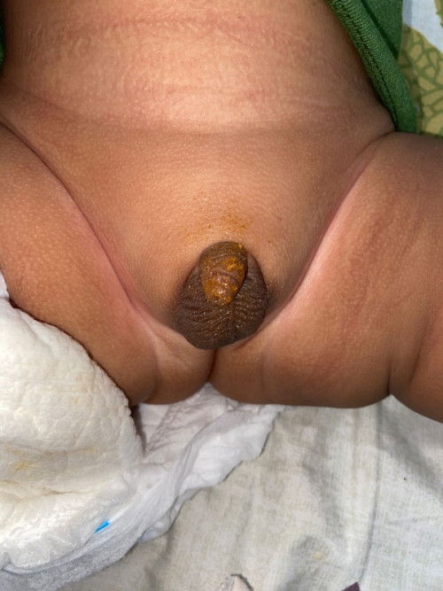 Keluar semacam serbuk di kemaluan