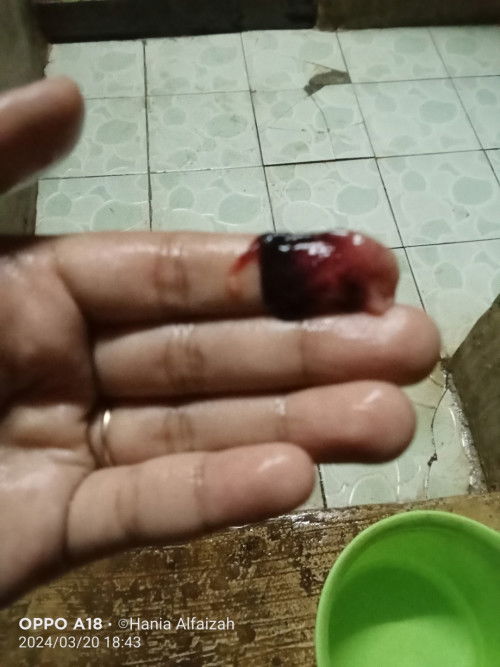 Darah haid atau bukan ?