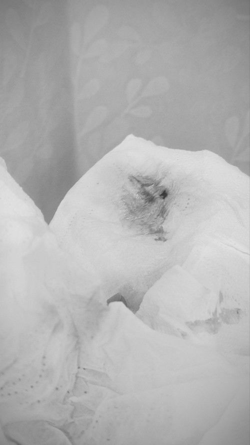 แท้งคุกคาม