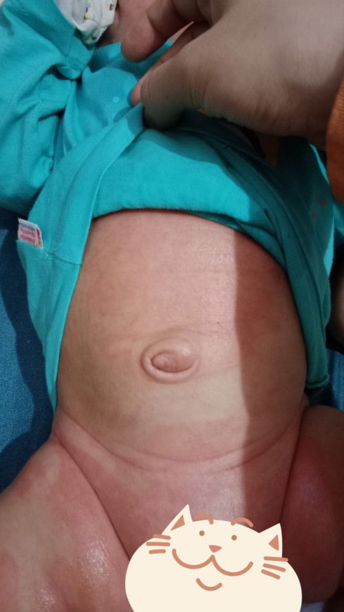 Trẻ sơ sinh bị viêm da