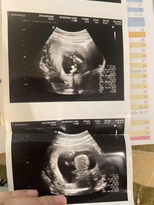 ปรึกษาน้ำหนักลูก