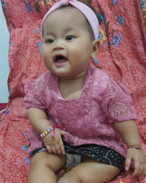 Tanda hitam di pipi bayi