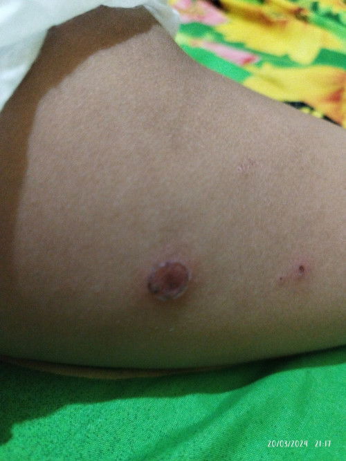 luka/ penyakit kulit