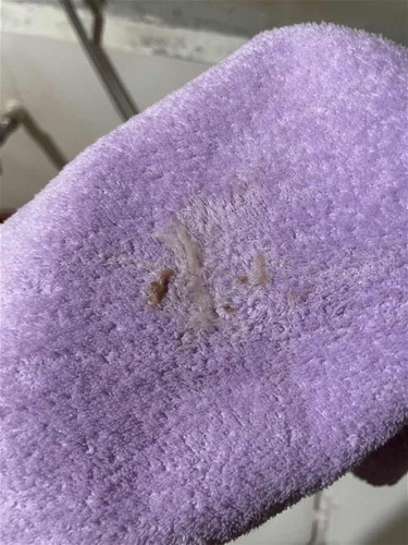brown discharge at 5weeks