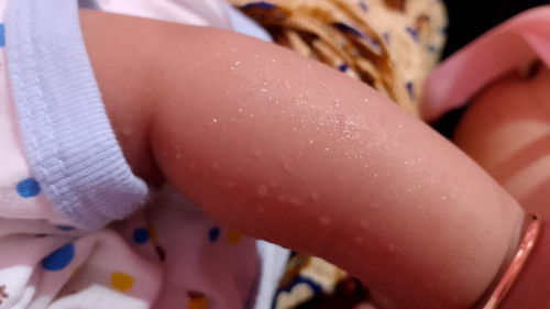 Keringat saat menyususi