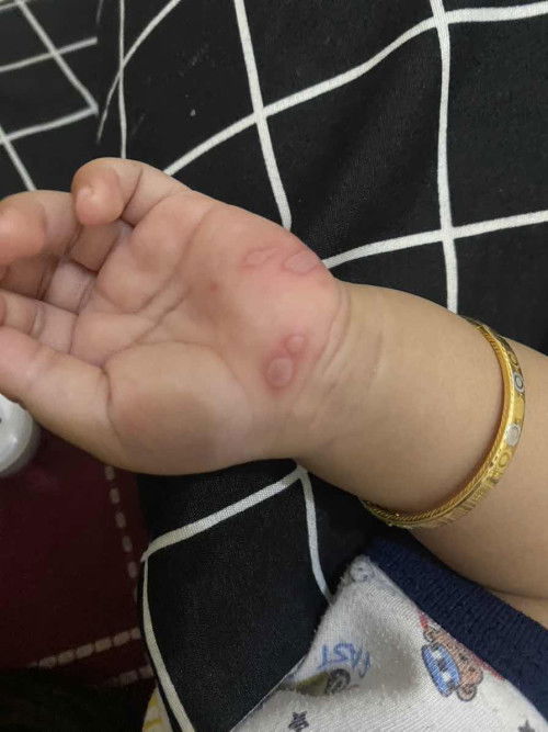 Minta sarannya dong bun