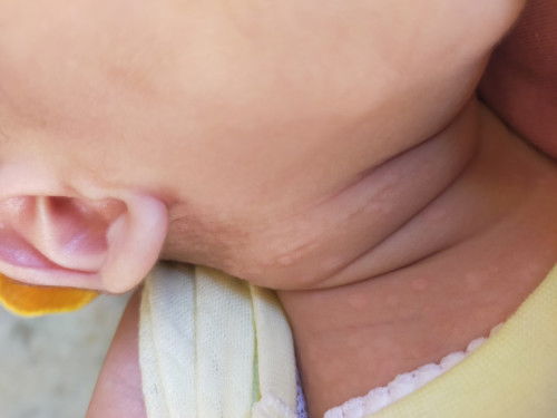 Bintik merah sampai Kya kena ulat .