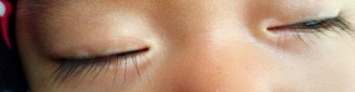 Kelopak mata anak berwarna putih