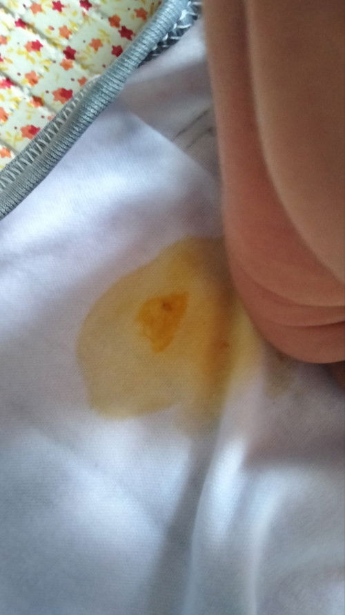 Ini BAK normal gak ya?