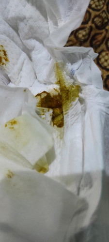 Ciri sufor tdk cocok utk bayi gimana ya? Bayi ku umur 5 hari, stiap dikasih susu langsung bab