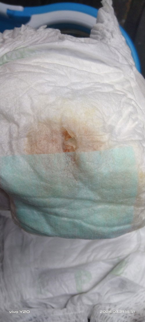 Kenapa kencing baby saya ada darah