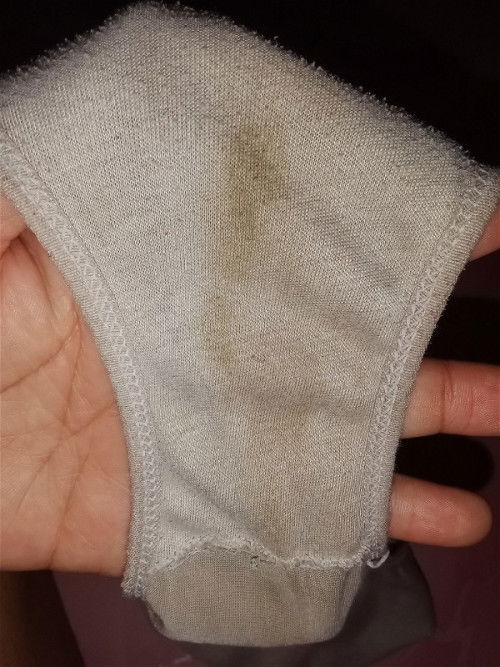 มีคราบสีน้ำตาลติดกกน.ท้องได้14w