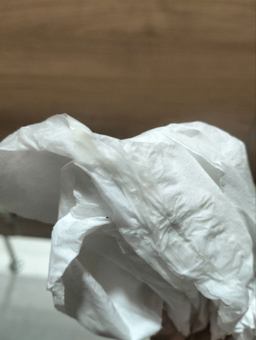 มุกสีขาวขุ่นใกล้คลอด