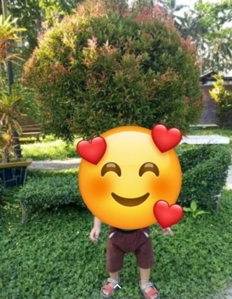 Bun anak saya kaki nya ngankang umur 17 bulan apa ka karna selalu memakai popok apa bisa lurus
