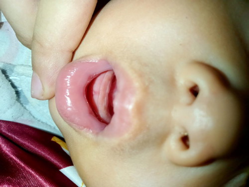 สอบถามแม่ๆแบบนี้ฟันกำลังขึ้นใช่มั้ยคะ
