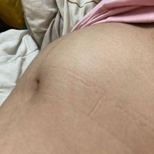 ขออนุญาติถามแม่ๆหน่อยค่ะแบบนีเคือน้องโก่งตัวหรืออะไรคะ