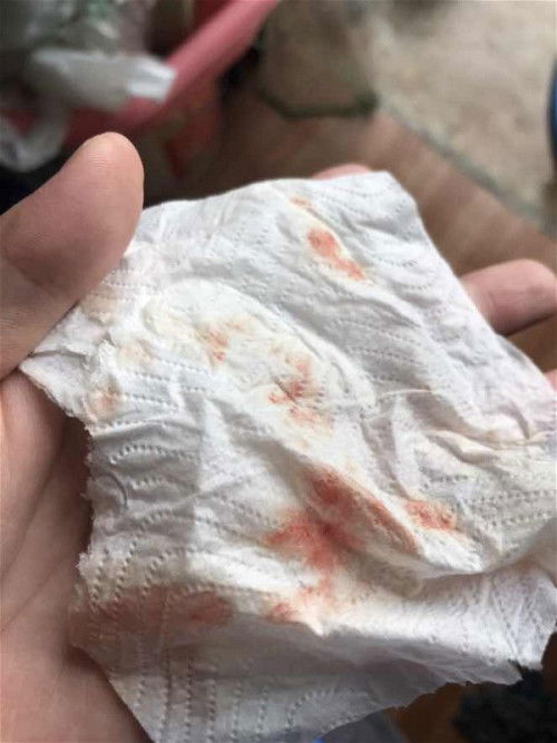 ขอคำแนะนำหน่อยค่ะ