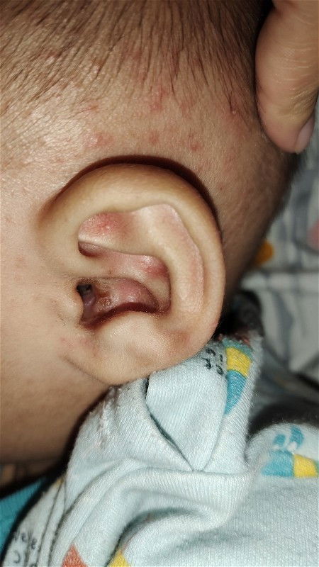 Kuping kotor dan area kuping ruam bintik2 merah..