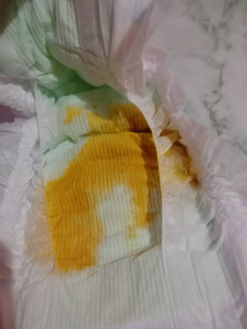 BAB bayi 1 bulan cair