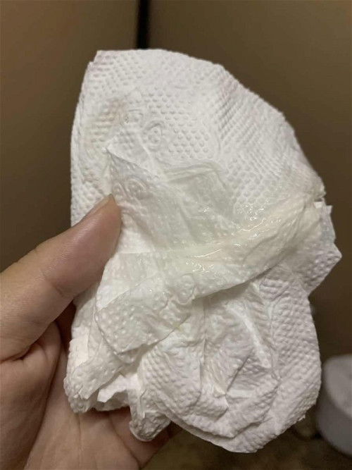 ท้อง38สัปดาห์ อันนี้เรียกว่าอะไรคะ เกิดจากอะไร