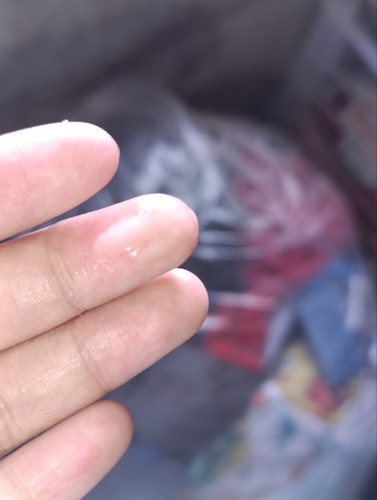 Milky Discharge