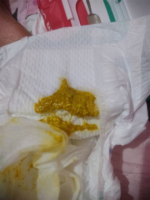 Bunda mau tanya saya new mom..maaf foto agak jorok