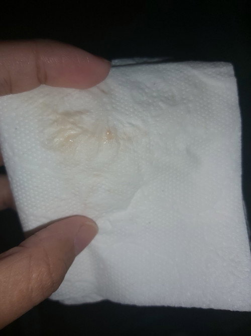 Discharge sa tissue