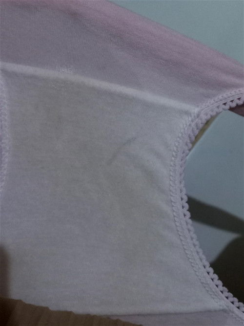 Cairan vagina berlebih atau ketuban rembes