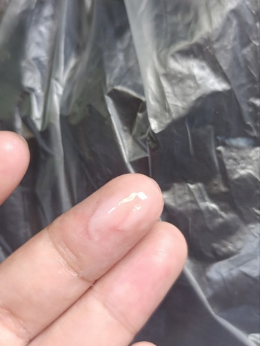 Milky Discharge