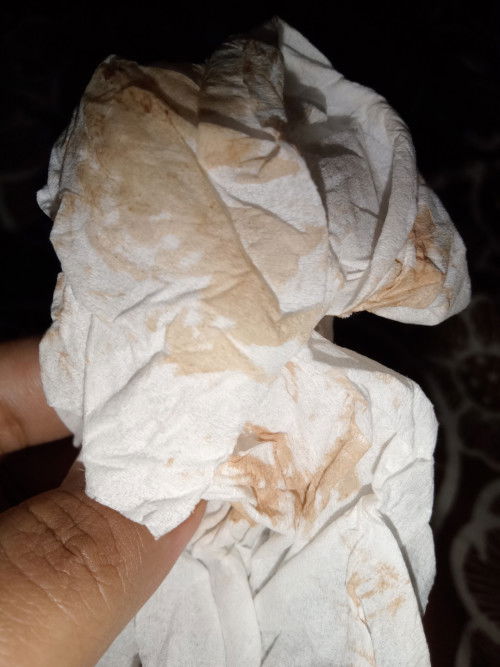 Keluar cairan coklat ga berbau