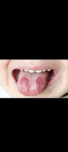 Bé e bú mẹ hoàn toàn ma bi như z, ik khám thuốc hk hết cứ tai ik tai lai mon nao bt cach chi e voi