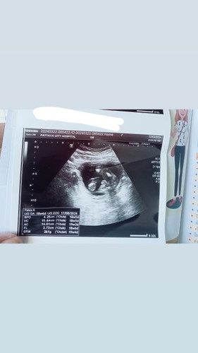 แม่ๆค่ะ น้อง 19วิก ทำไมในใบซาวบอกกำหนดคลอด 18/8/2024ค่ะ กำหนด ต้องยึดตามประจำเดือนหรือใบซาว