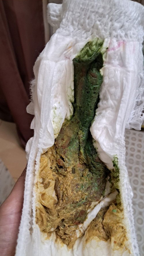 Sharing dong mom,Feses anak 13 bulan berwarna hijau kenapa ya?