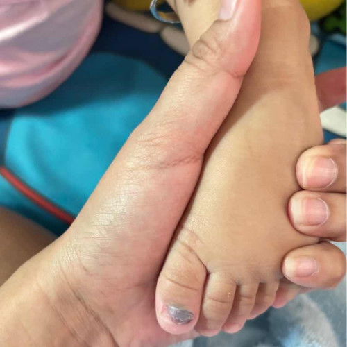 ลูกสาว 1 ขวบ เล่นของหล่นทับ