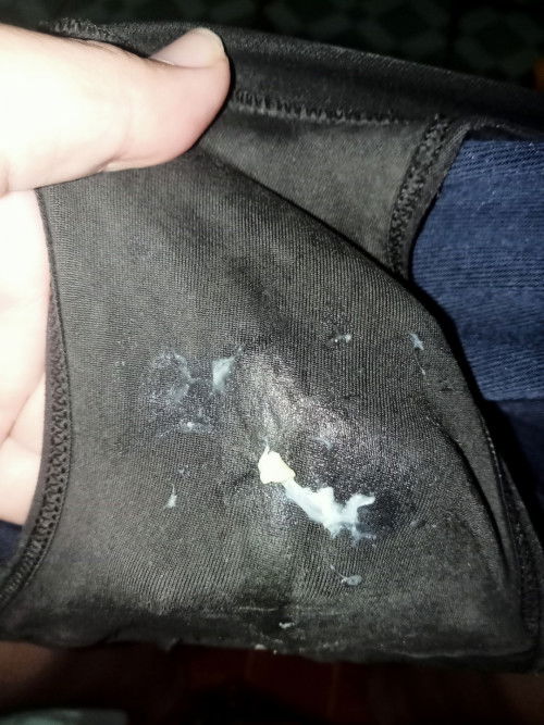 31+6wตกขาวเยอะ