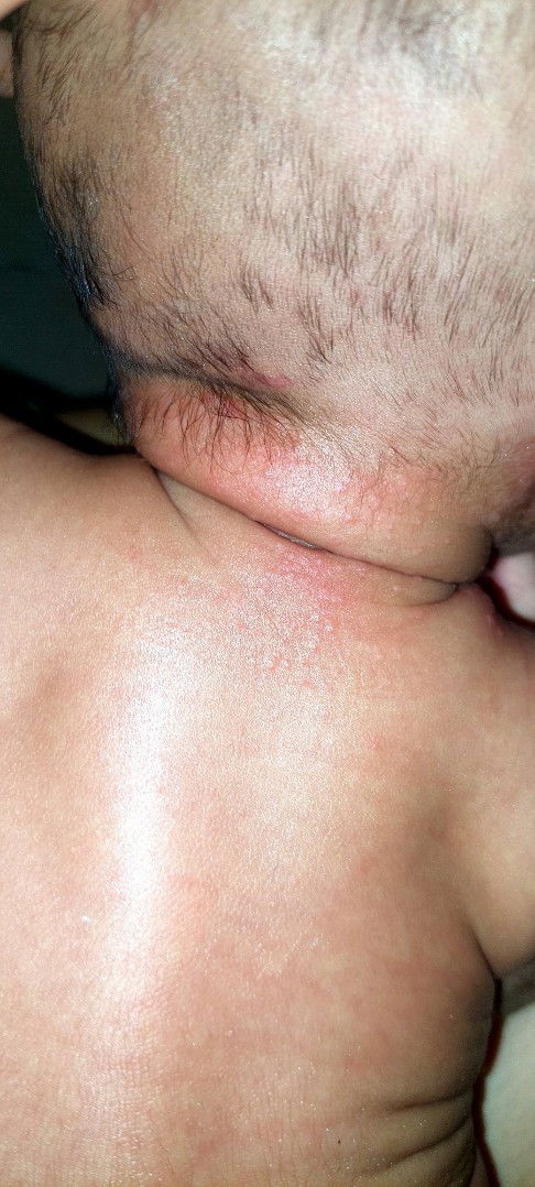 Minta saran solusi bund