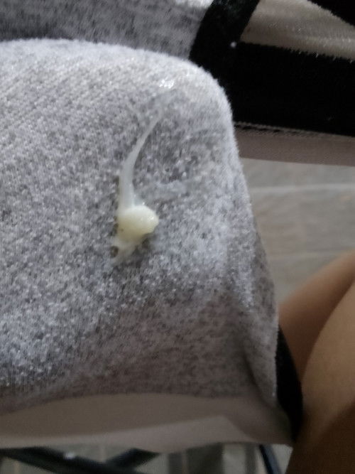 มีมูกใสๆออกม่จากช่องคลอดแบบนี้เขาเรียกว่าอะไรค่ะอายุครรภ์38+4ค่ะขอสอบถามแม่ๆหน่อยค่ะ