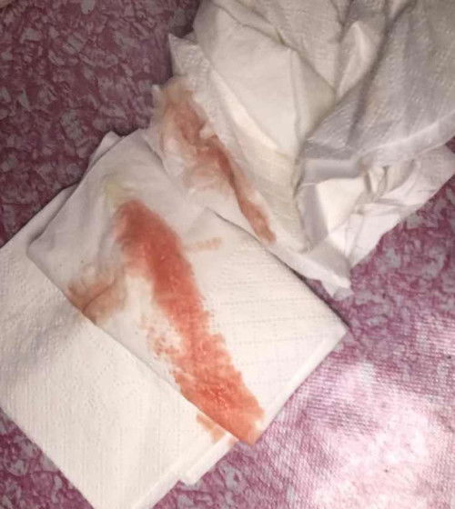 น้ำคาวปลาแบบนี้ปกติไหม