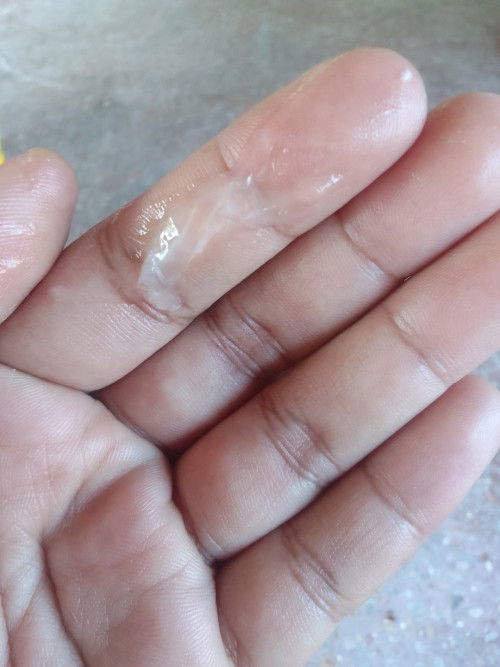 มีมูกใส+ท้องแข็ง