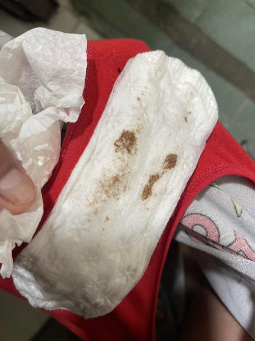 Brown Discharge at 37weeks and 4days