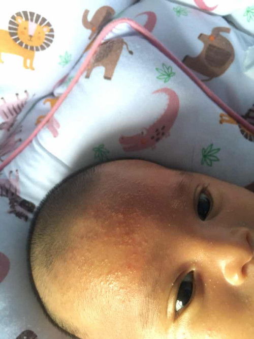 Ada yg sama baby merah2 kaya gini, tp sehari ilang besok muncul lagi gitu terus